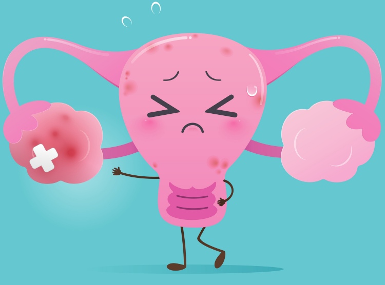 Premature Ovarian Failure Treatment in New York